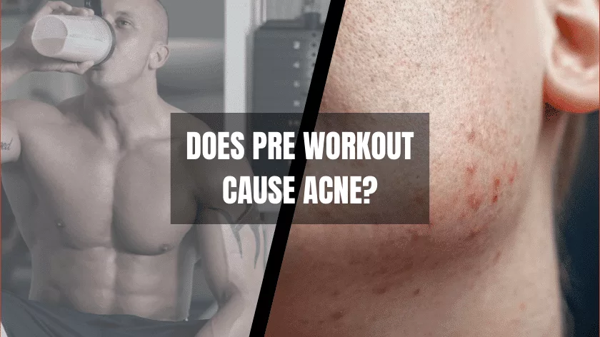 does-pre-workout-cause-acne