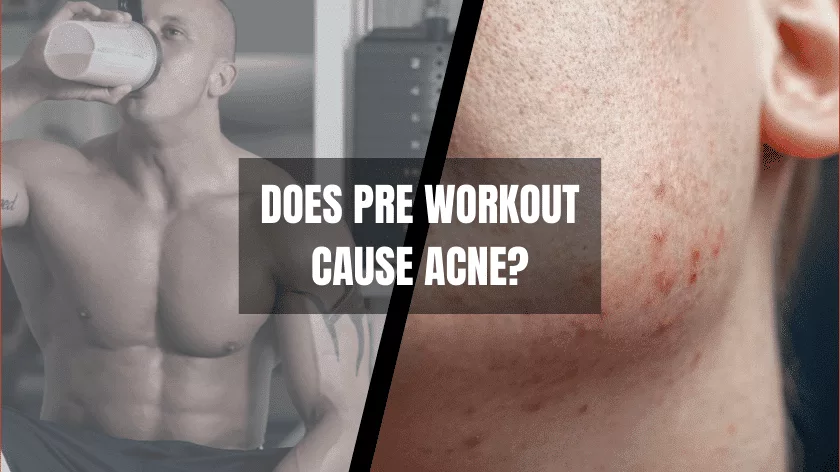 does-pre-workout-cause-acne-a-closer-look